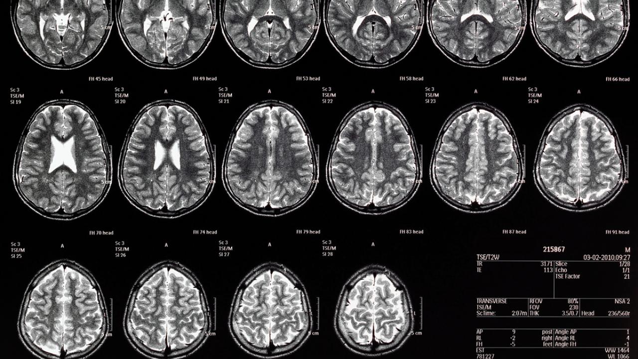 Deped Mri Video-Based Education Reduces Distress in Pediatric MRI Patients ...